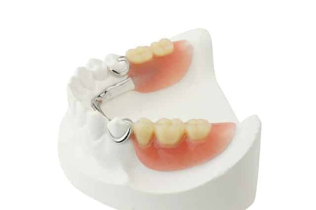 Partial Chrome Metal Denture